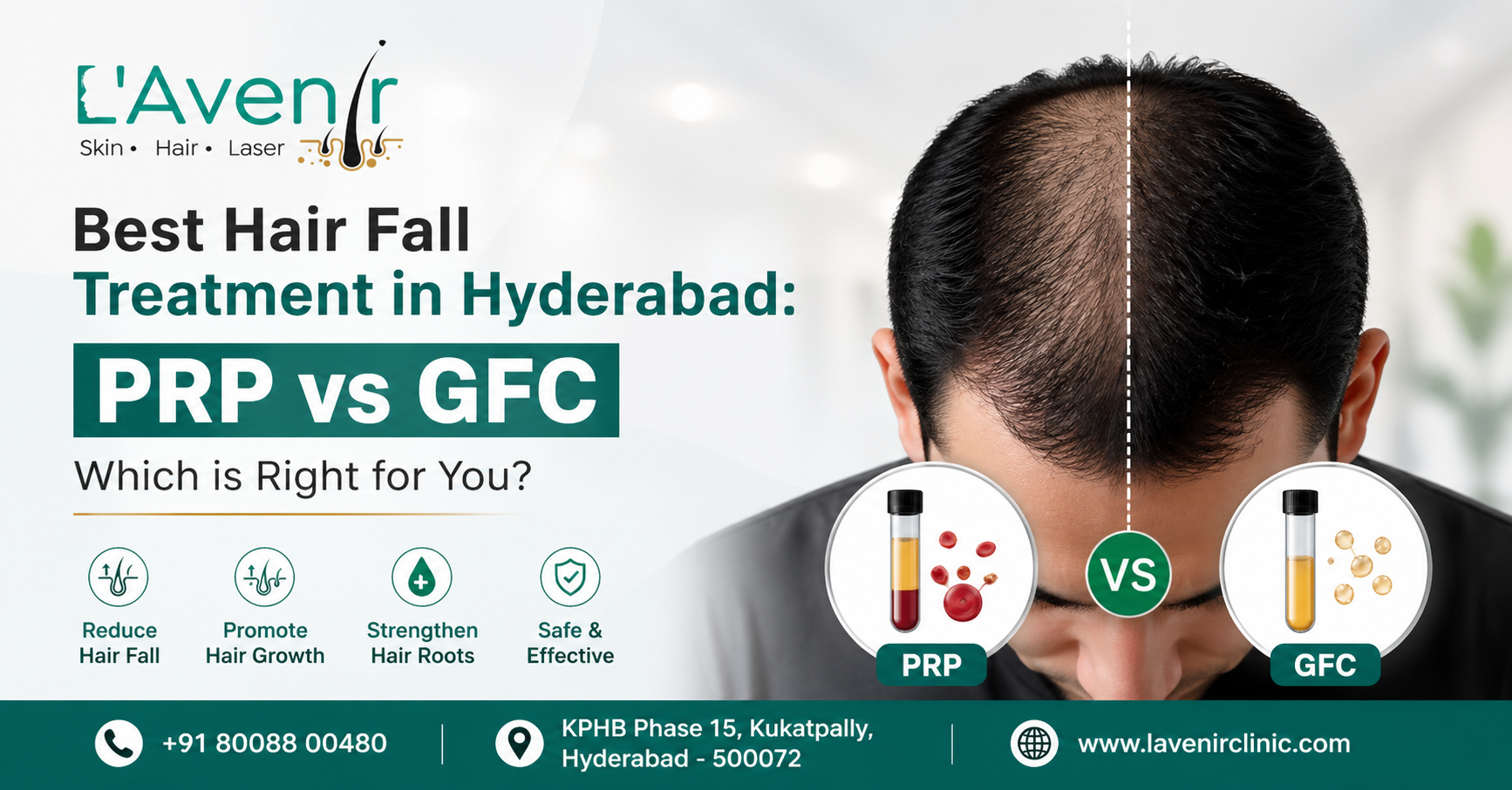 PRP vs GFC Hair Treatment in Hyderabad